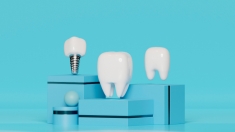 Implanty stomatologiczne: Zalety, proces wszczepienia i pielÄ™gnacja
